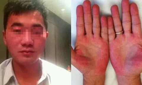 Người đàn ông không bia rượu nhưng ngày nào cũng bị kiểm tra nồng độ cồn, biết sự thật phía sau ai cũng xót xa