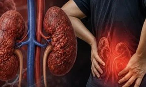 Chuyên gia cảnh báo: 5 VIỆC hay làm buổi sáng có thể “phá hủy” thận âm thầm, nhiều người Việt không biết nên vô tình mắc phải