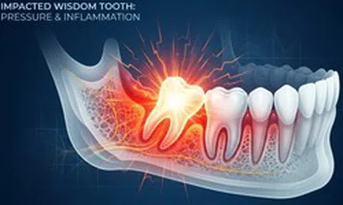 Tại sao gọi là răng khôn dù nó mọc rất 'dại' và gây đau đớn?