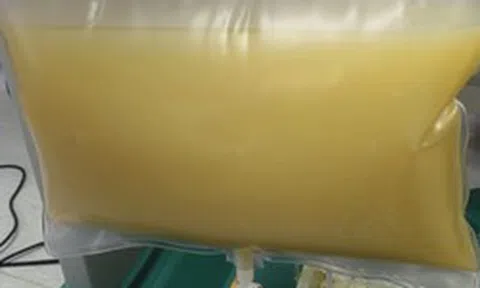 Máu trắng đục như sữa, nam sinh viên gặp biến chứng vì kiểu ăn uống quen thuộc
