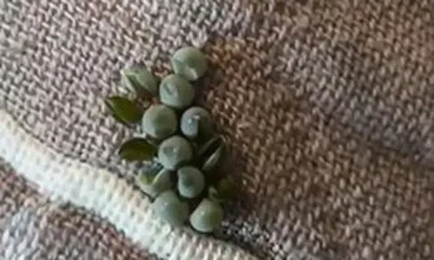 Vừa ngủ dậy thấy "chuỗi ngọc" trên gối, người đàn ông kiểm tra rồi lạnh người: Số lượng hơn 10