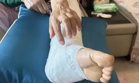 Xem nhẹ nốt ruồi ở nơi cực hiếm ai để ý, người phụ nữ "hối không kịp" vì ung thư đã di căn