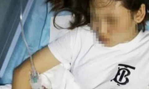 Nữ sinh 21 tuổi đau bụng, đau lưng kéo dài, đi khám bác sĩ phát hiện: Người thường có 2, cô có tới 3…