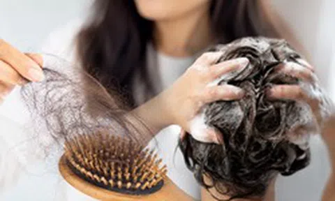 4 thói quen xấu hàng ngày có thể dẫn đến rụng tóc, khuyên bạn nên thay đổi càng sớm càng tốt nếu không muốn bị hói đầu sớm