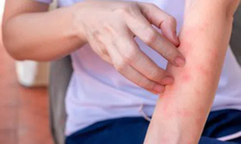 Nếu bạn có hai vùng da bị ngứa dai dẳng trên cơ thể, hãy cảnh giác vì đó có thể là dấu hiệu của ung thư gan