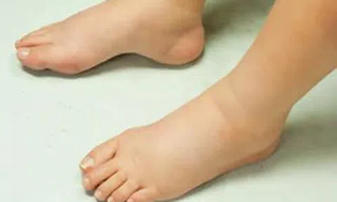 9 dấu hiệu thận đang ‘kêu cứu’