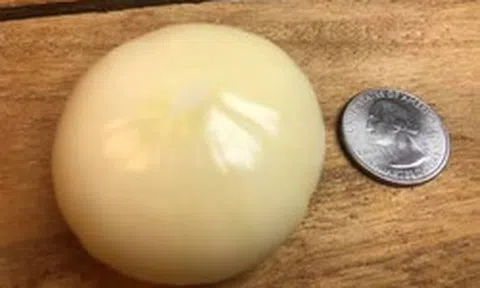 Trồng tỏi gần 1 năm, người đàn ông 67 tuổi đào lên rồi sững sờ: Một kỷ lục thế giới mới được xác lập!