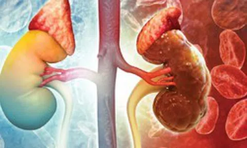 Thói quen hàng đầu gây hại cho thận: Nhiều người làm từ khi còn trẻ mà không biết