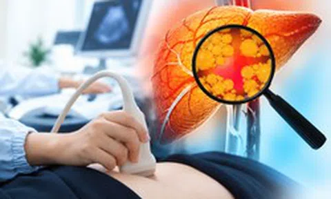Chăm tập thể dục, kiêng chất béo nhưng gan vẫn nhiễm mỡ: Bác sĩ Bạch Mai chỉ ra nguyên nhân