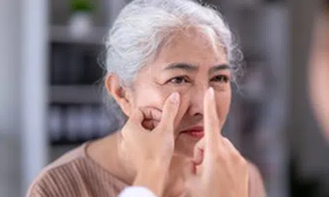 Gan nhiễm mỡ có thể nhận biết qua khuôn mặt: 3 dấu hiệu trên cơ thể cảnh báo bệnh, bao gồm cả đường chỉ tay và lưỡi