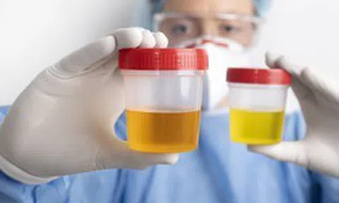 5 thói quen tàn phá thận mỗi ngày: Nam giới mắc nhiều tới mức thấy quen thuộc